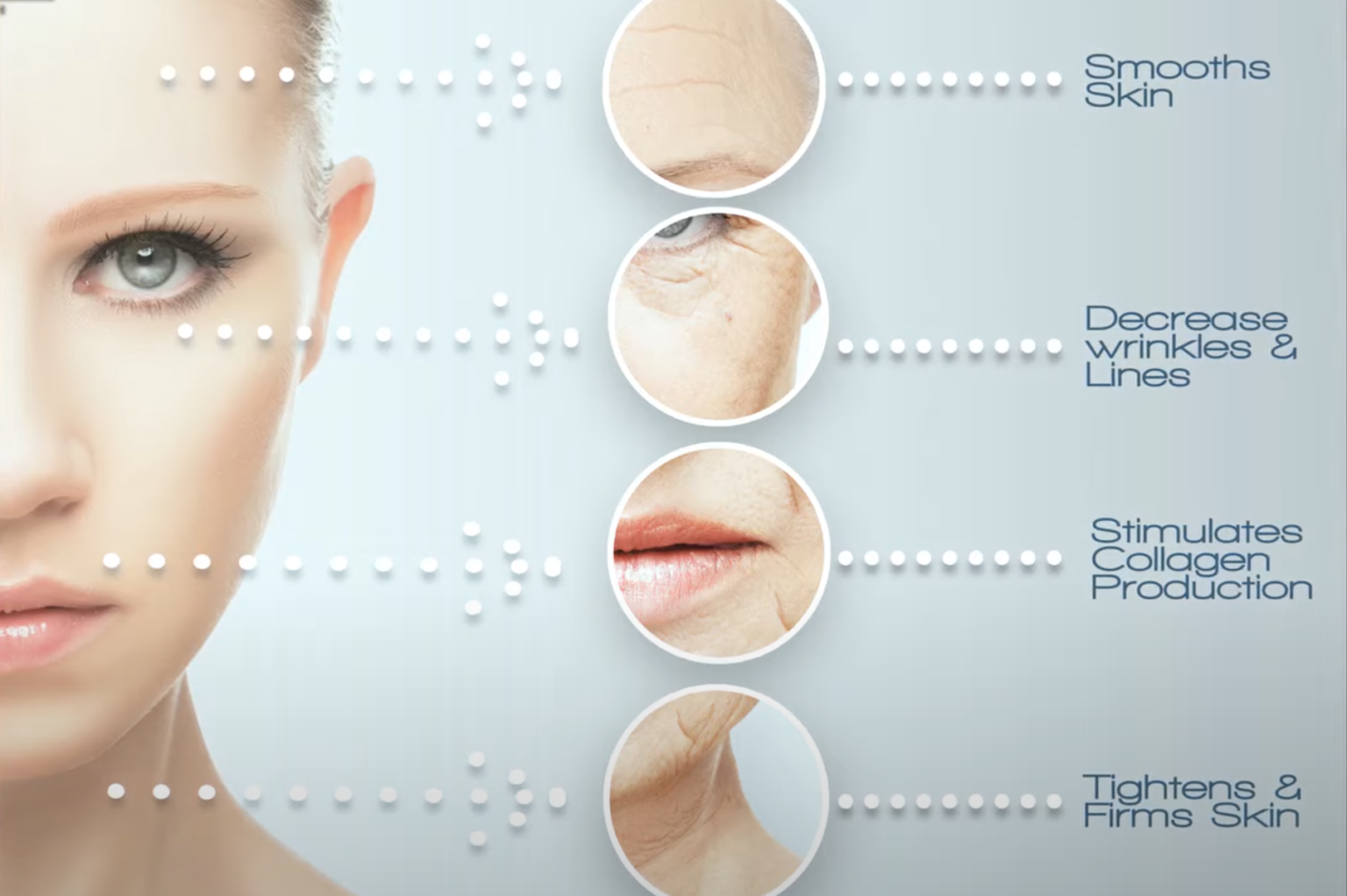 Liquid Nitrogen Treatment Christie Care