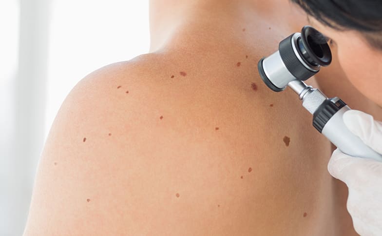 Dermatology Skin Cancer Screening Christie Care